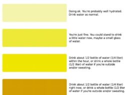 The Meaning of Urine Color: A Guide to Understanding Cloudy Urine and its Significance in Health – Urine Color and Odor Chart for Normal and Abnormal Urine Colors